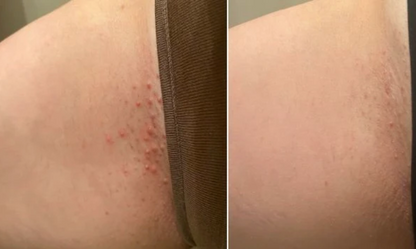 🧁Silk Skin Ritual Set✨